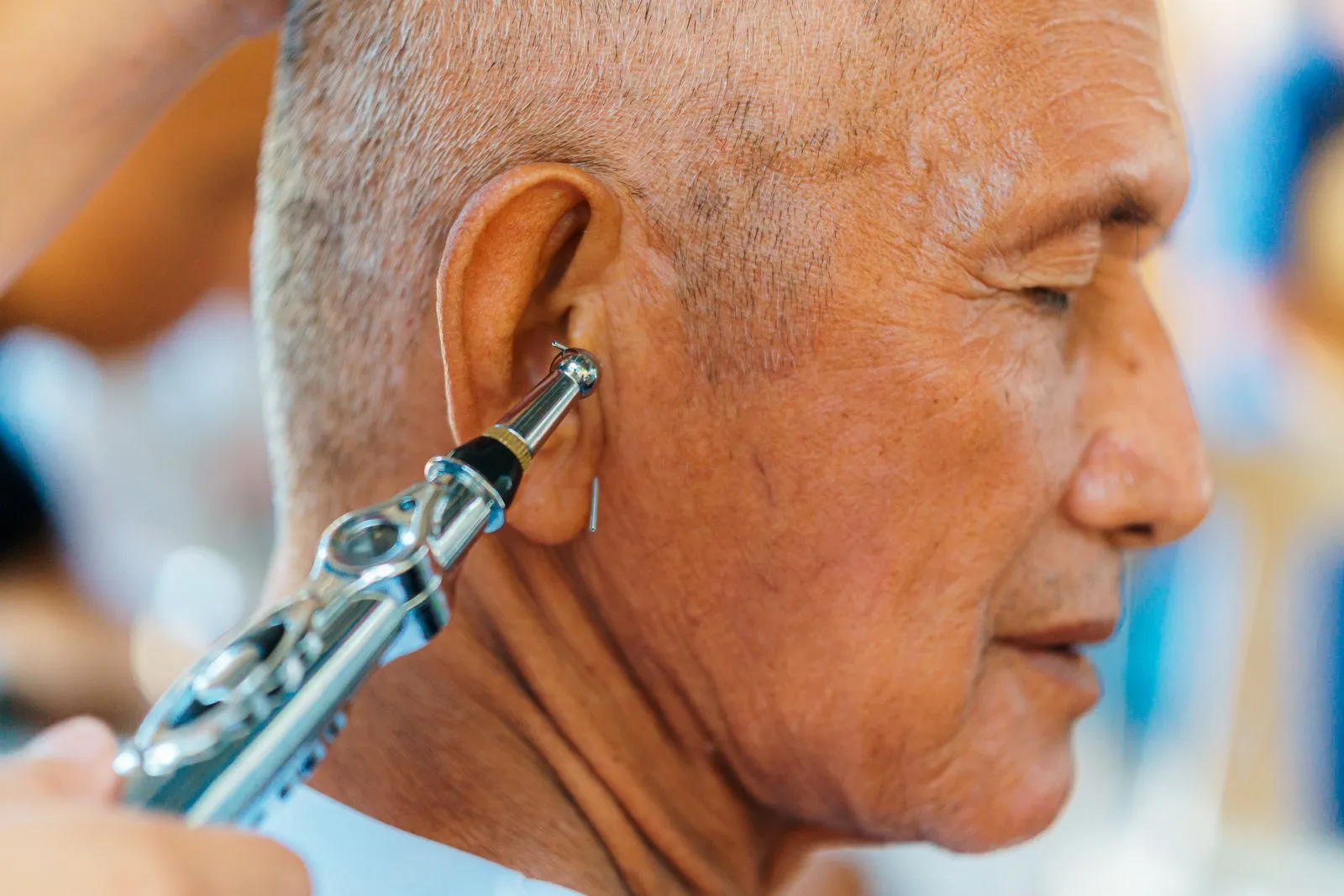 Close-up of a senior man getting an ear acupuncture treatment for relaxation and wellness.
